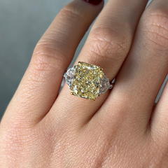 Close-up of a hand wearing a diamond ring with a yellow diamond center stone.